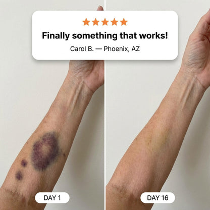 100K+ SOLD💕 Bruise Repair & Skin-Strengthening Cream